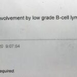 Lymphoma Medical Report