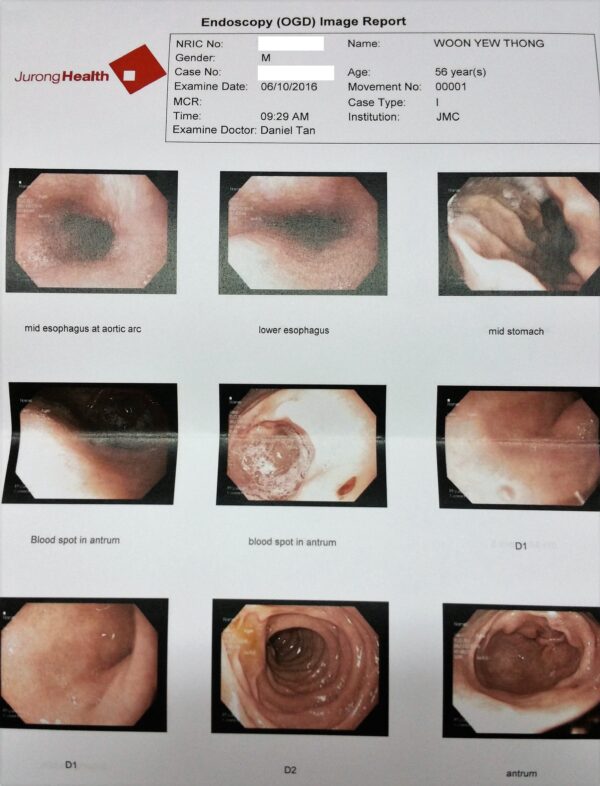 Endocolonsopy Result