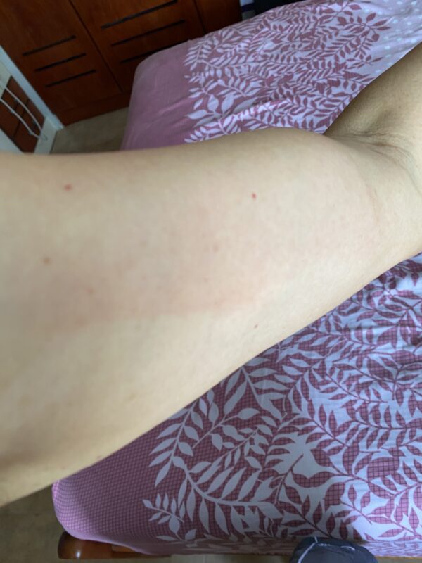 My first and Second vaccination shots are from Pfizer