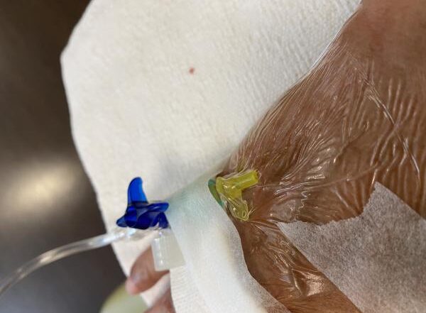 Chemotherapy experience