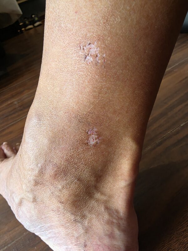 Photo taken right after the motorbike accident